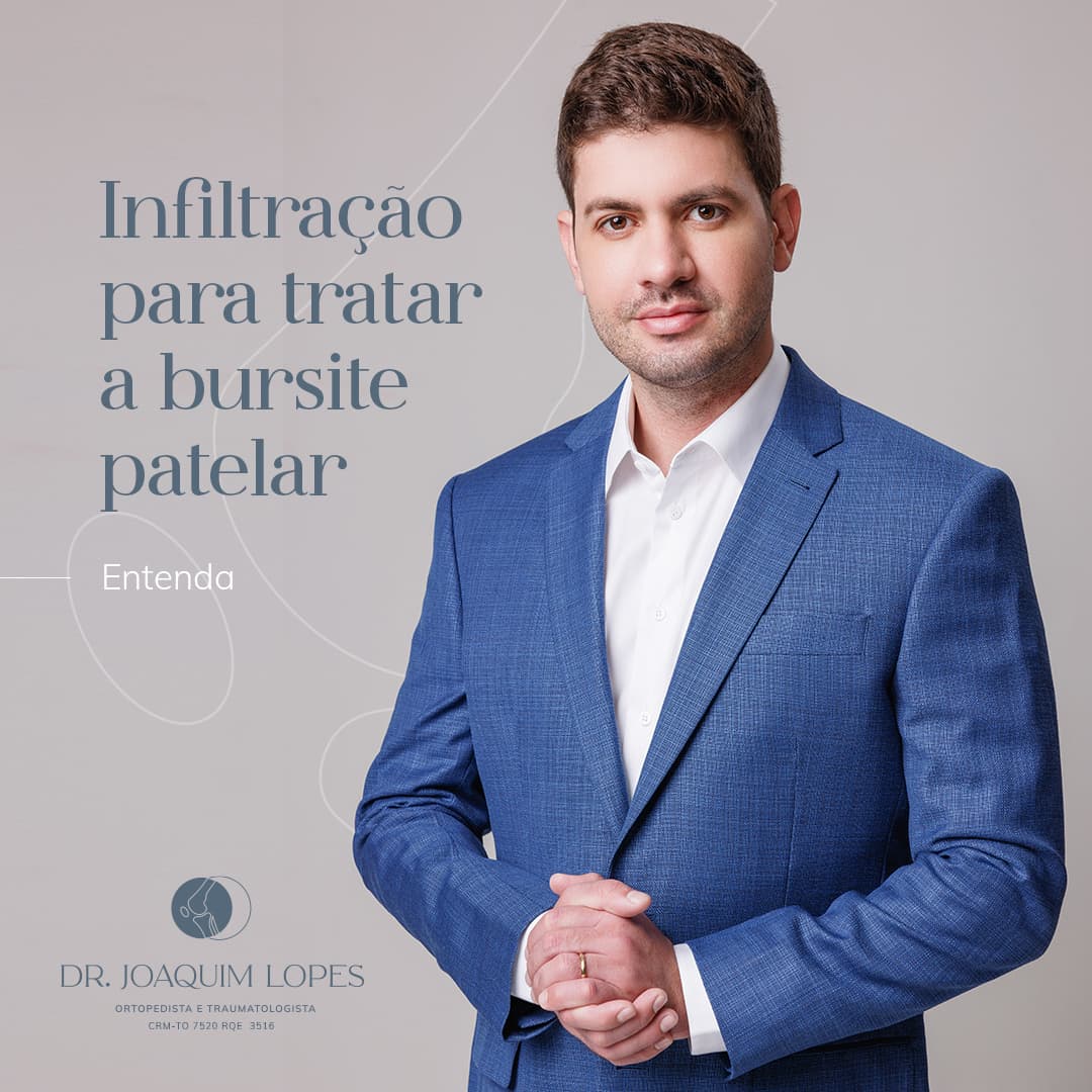 Infiltração para tratar a bursite patelar